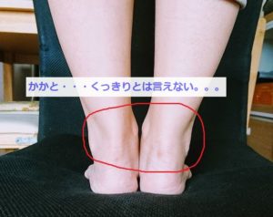 老廃物のたまったかかと